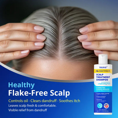 TAGRID 1% Ketoconazole Scalp Support Shampoo - Controls oil, clears dandruff, soothes itch, and leaves scalp fresh and comfortable.