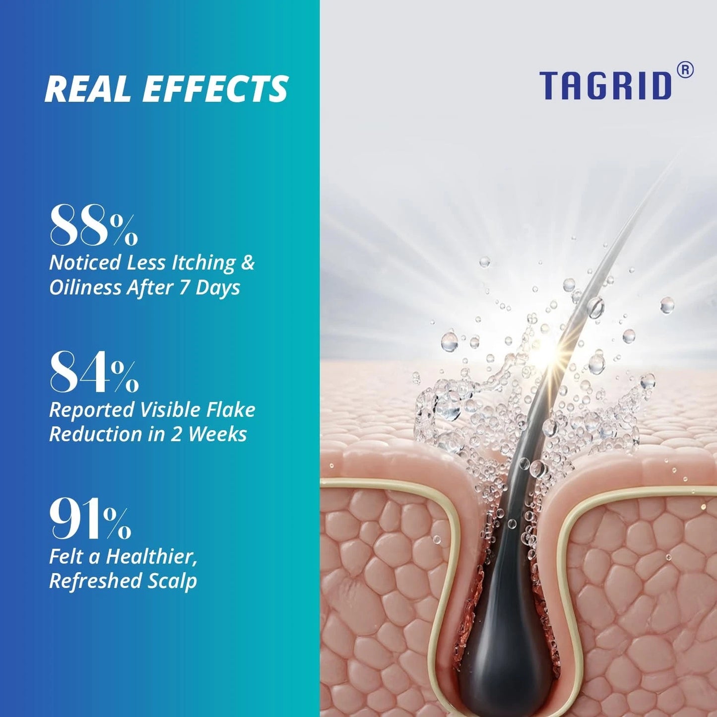 TAGRID Anti-Fungal Herbal Shampoo - Real effects with 88% reported less itching and oiliness after 7 days, 84% visible flake reduction in 2 weeks, and 91% felt a healthier, refreshed scalp