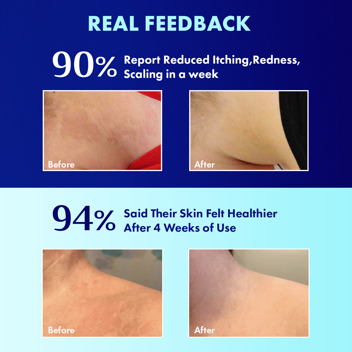 TAGRID Antifungal Cream - Real customer feedback showing relief from itching, redness, and scaling in a week, with 90% satisfaction