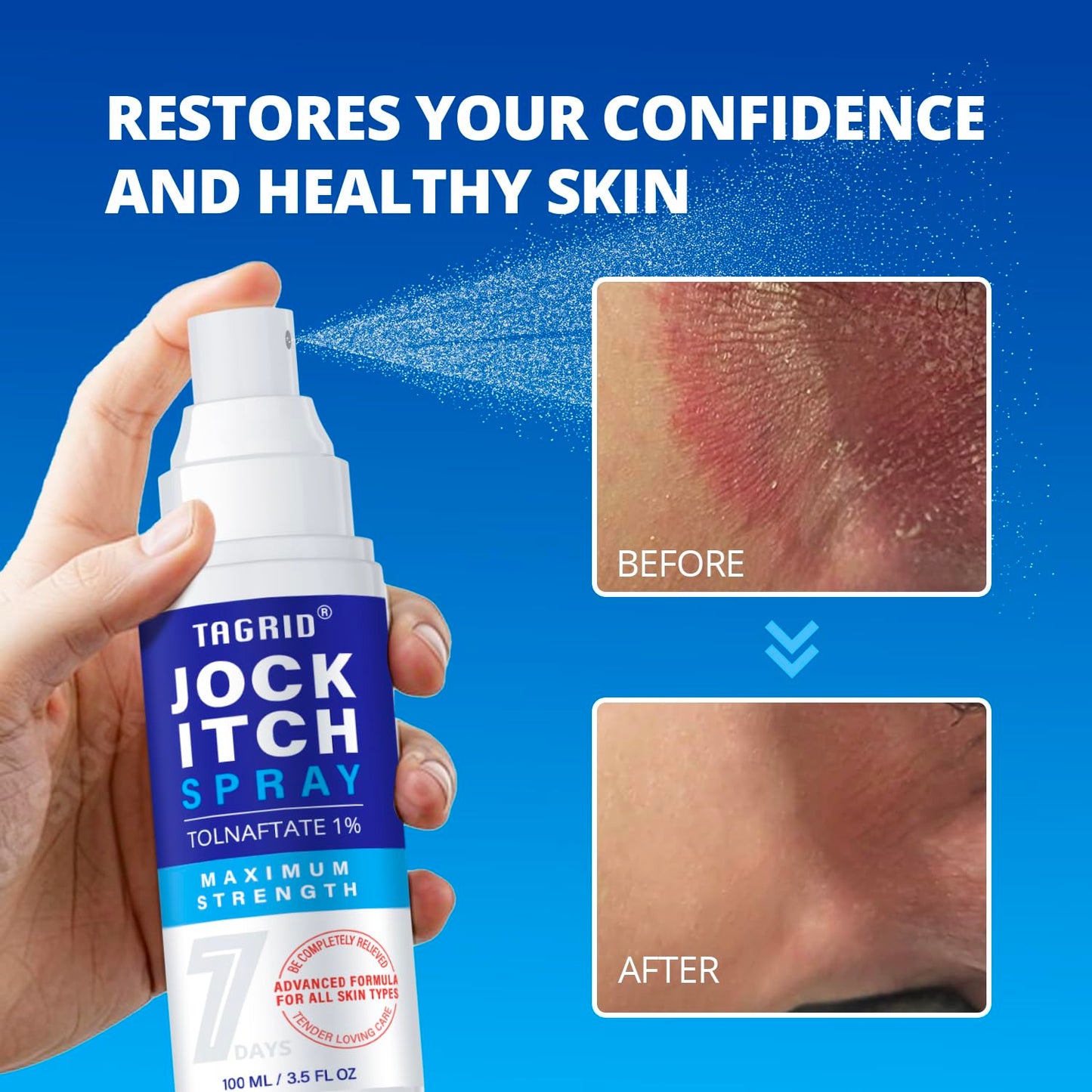 before and after results of antifungal jock itch spray showing reduced redness, irritation, and clearer healthier skin