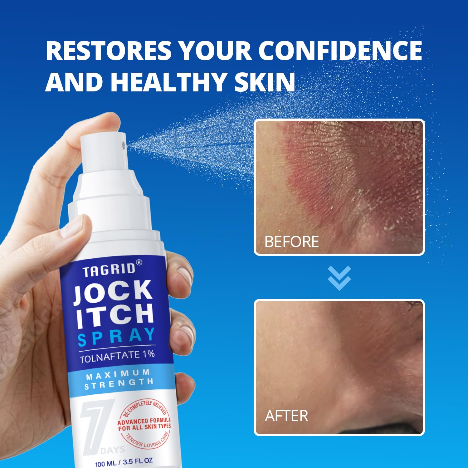 before and after results of antifungal jock itch spray showing reduced redness, irritation, and clearer healthier skin