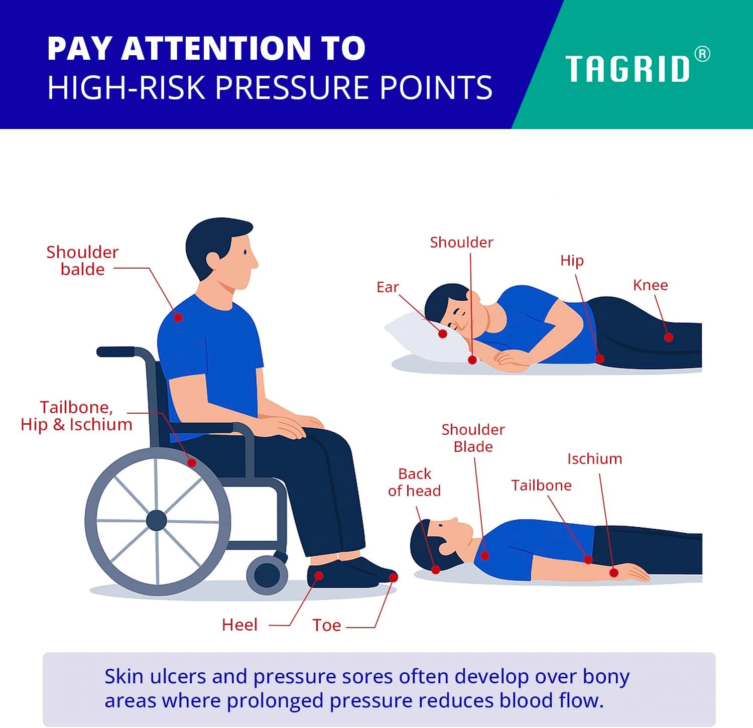 diagram showing high risk pressure points on the body where skin may need extra protection and care during prolonged sitting or lying
