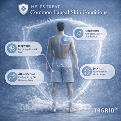 TAGRID antifungal soap supports care for common fungal skin conditions including athlete foot ringworm and jock itch for daily body cleansing