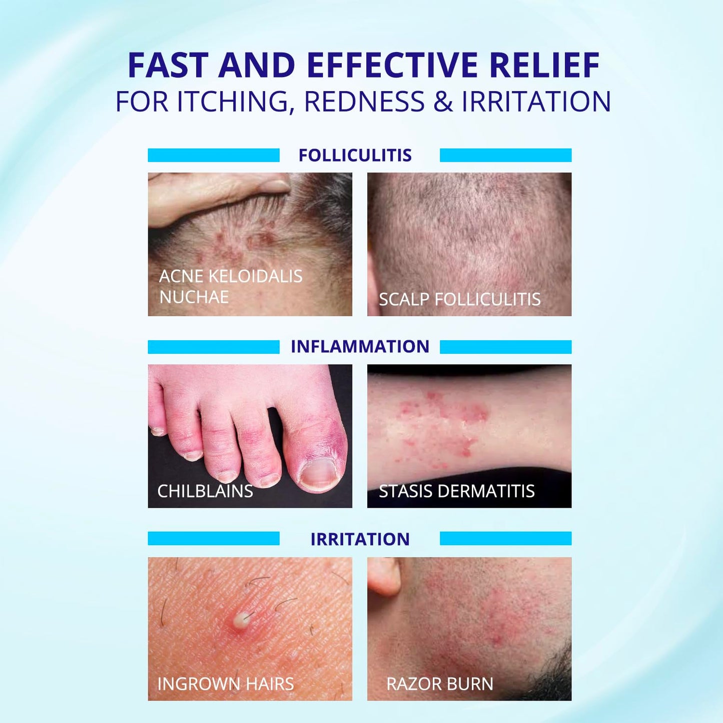 TAGRID folliculitis relief supports skin care for irritation redness and ingrown hair with visible improvement over time