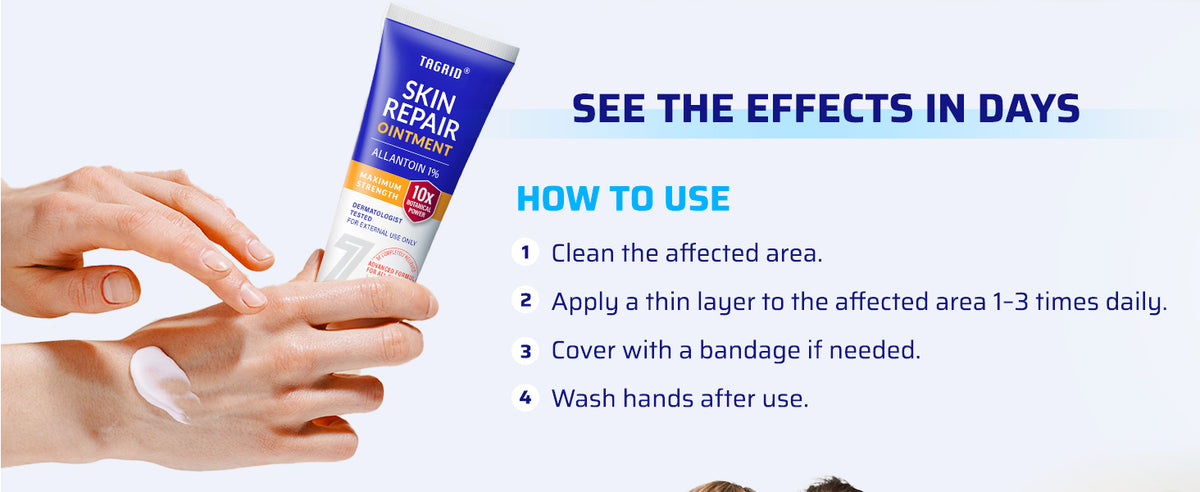 TAGRID Skin Repair Ointment application on hand with step by step instructions showing how to apply thin layer on affected area daily for skin protection and repair care