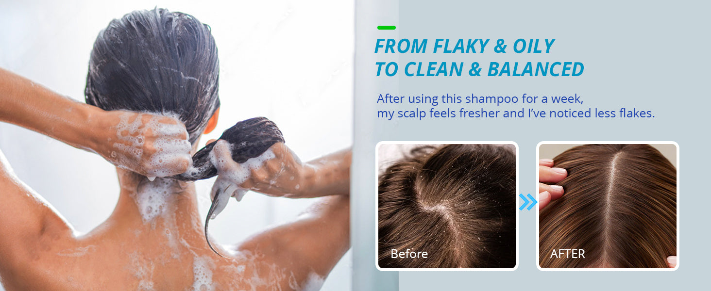 Tagrid Shampoo From Flaky and Oily to Clean and Balanced Scalp - Visible Results After One Week