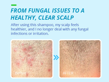 TAGRID Anti-Fungal Shampoo 300mL