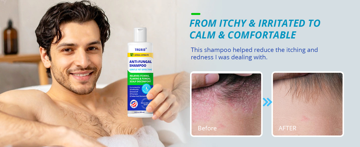 Tagrid Shampoo From Itchy and Irritated to Calm and Comfortable Scalp - Relief from Redness and Itching