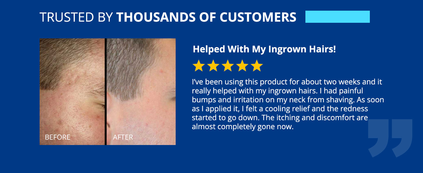tagrid folliculitis cream before and after results, helps reduce ingrown hair razor bumps and redness, visible skin improvement after consistent use, soothing irritated shaving area
